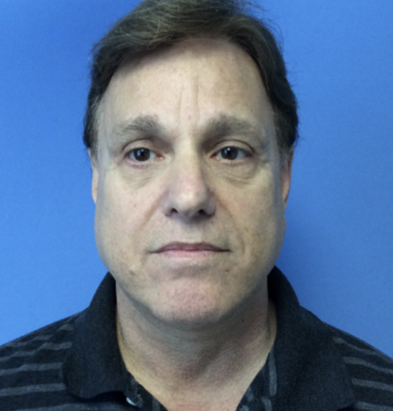 Face--amp--Neck-lift | After Face